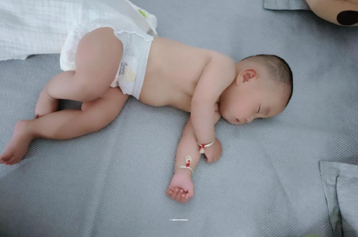 鞍山六个月宝宝眼睛散光